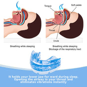 Customizable Mouthpiece Guard for Effective Snoring Relief 2