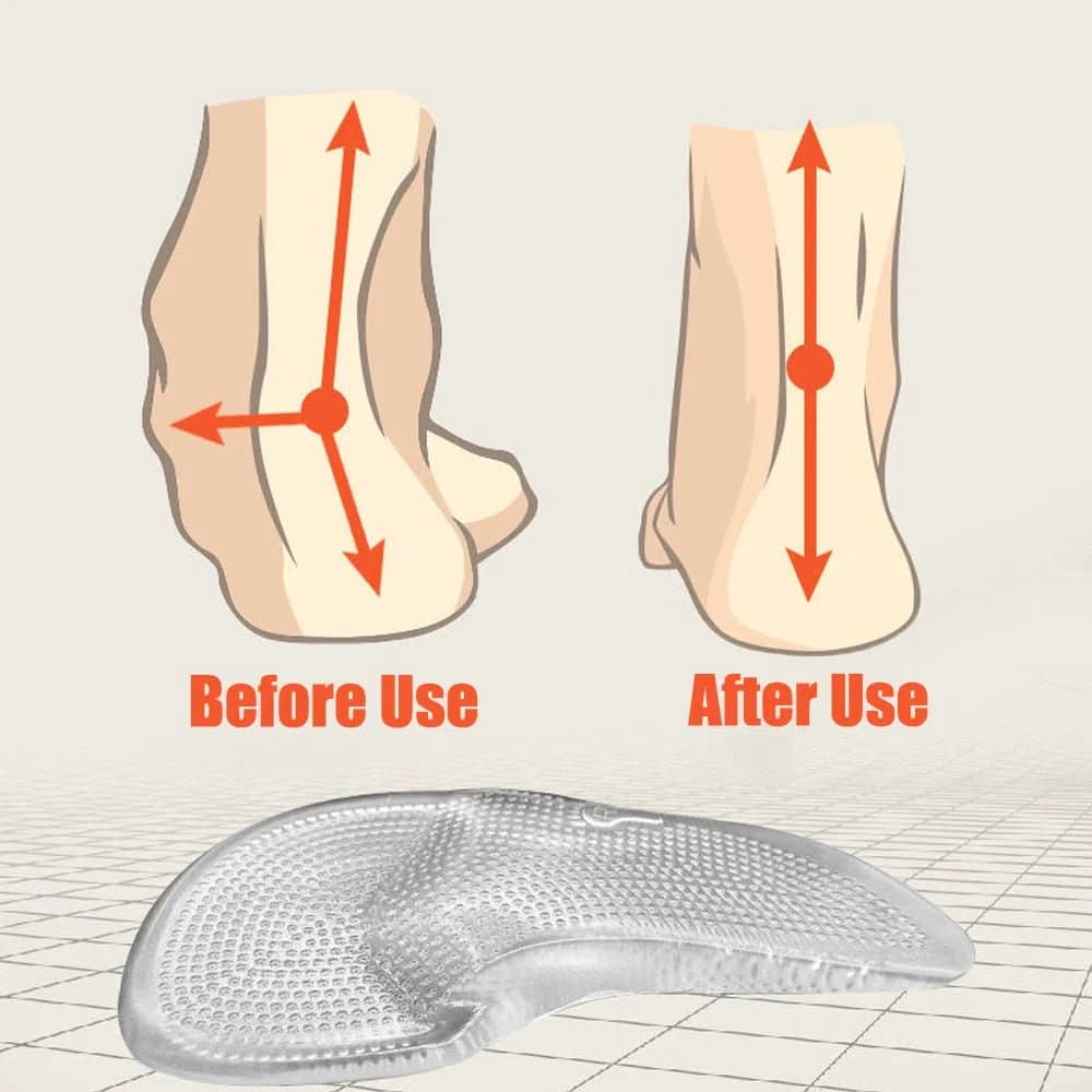 FasciaFix Gel Foot Inserts for Plantar Fasciitis Relief and Arch Support 5