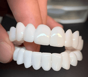 FlexiSmile Dentures with Natural White Lenses for a Comfortable and Elegant Smile 0