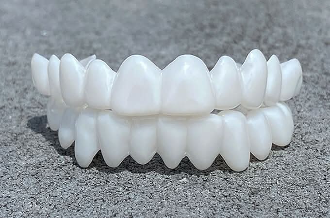 FlexiSmile Dentures with Natural White Lenses for a Comfortable and Elegant Smile 1