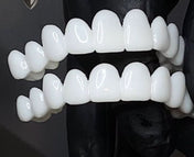 FlexiSmile Dentures with Natural White Lenses for a Comfortable and Elegant Smile 4