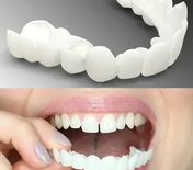 Snap-On Dentures for a Natural Smile Enhancement 2