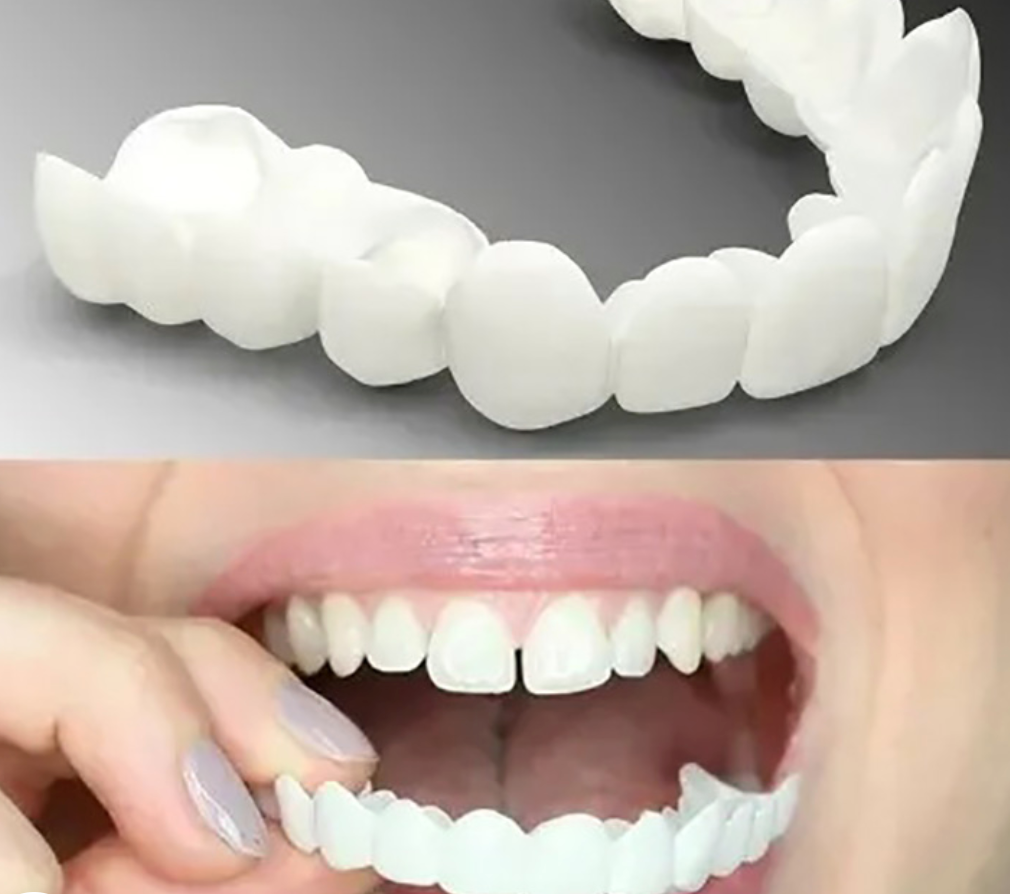 Snap-On Dentures for a Natural Smile Enhancement 2