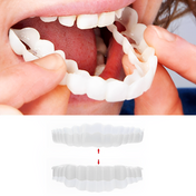 Snap-On Veneers Set for a Perfect Smile - Upper and Lower Medical-Grade Silicone 0