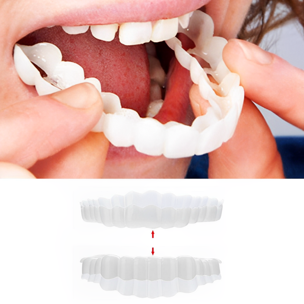 Snap-On Veneers Set for a Perfect Smile - Upper and Lower Medical-Grade Silicone 0