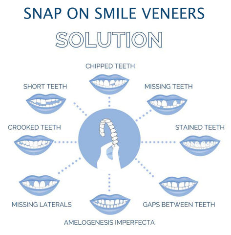Snap-On Veneers Set for a Perfect Smile - Upper and Lower Medical-Grade Silicone 5
